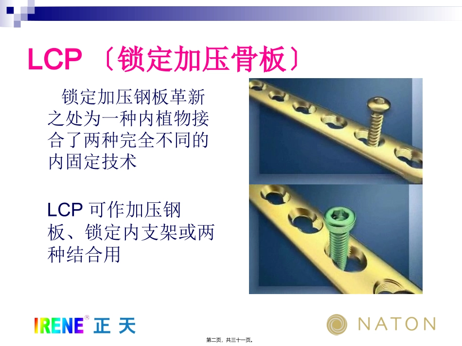 LCP系统接骨板的注意问题及常见问题(免金币)_第2页