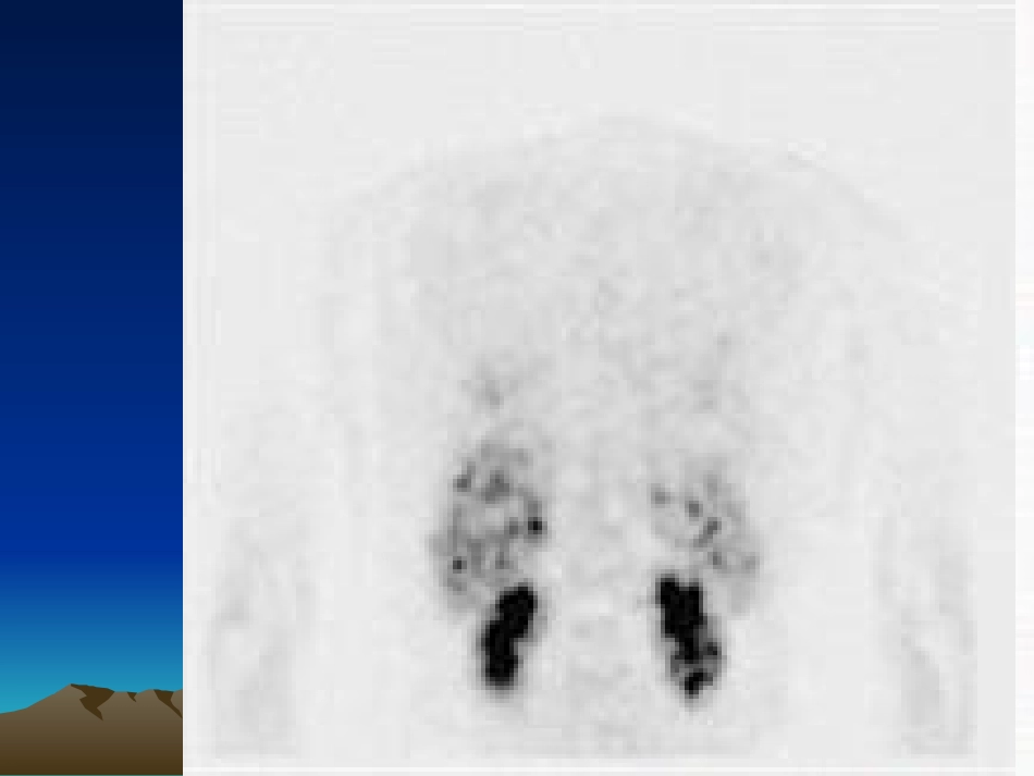 2022年医学专题—最新PET病例-PPT文档_第2页