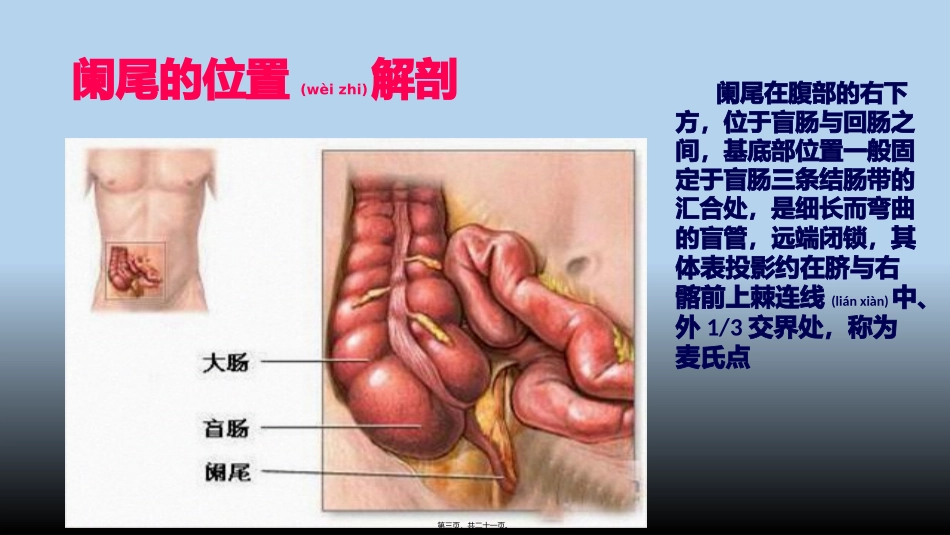 2022年医学专题—最新阑尾炎PPT_第3页