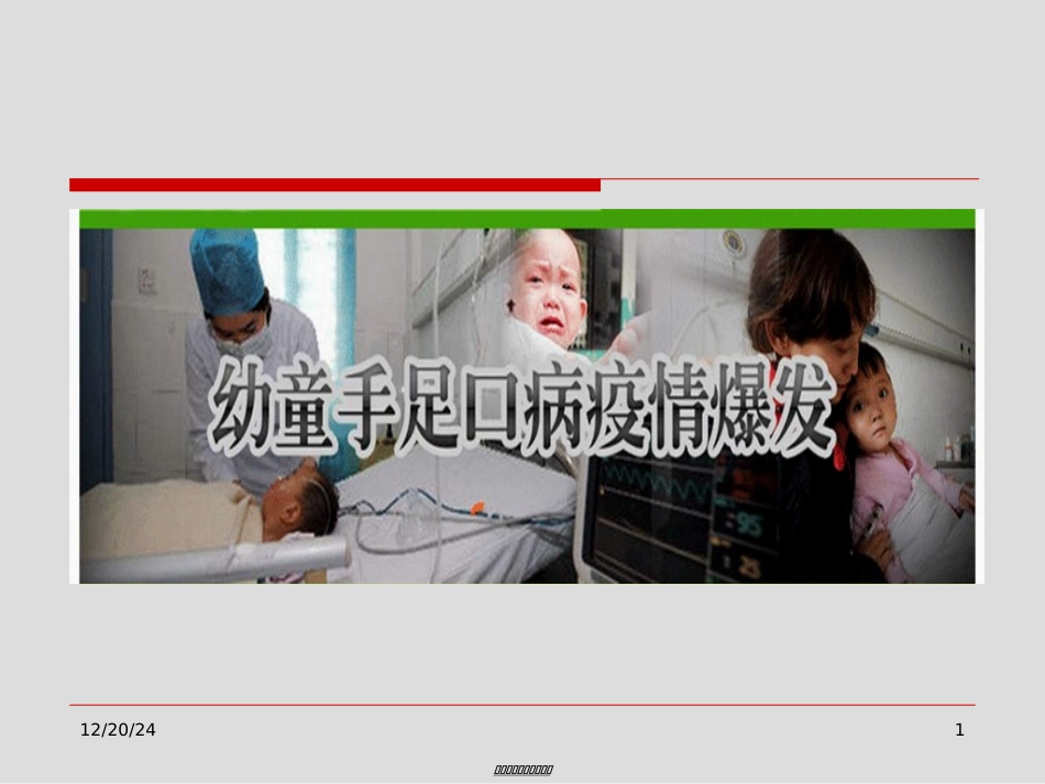 2022年医学专题—最新手足口病神经系表现山西医科大学第二医院儿科-PPT文档_第1页