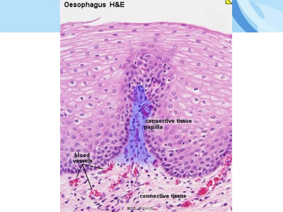 Chapter3-Connective-Tissue-prooper(固有结缔组织)_第3页