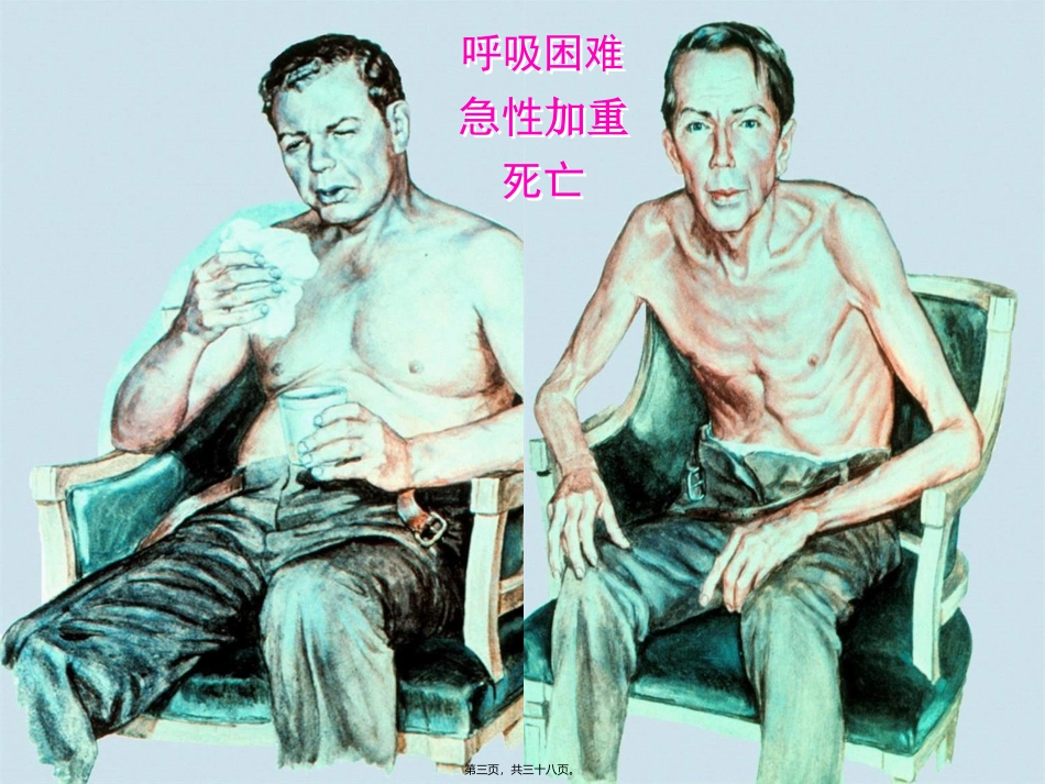 COPD多媒体医院讲课2_第3页