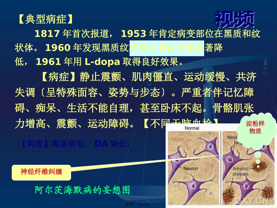 cq抗帕金森病解读_第3页