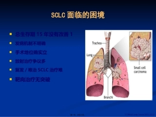 CSCO小细胞肺癌