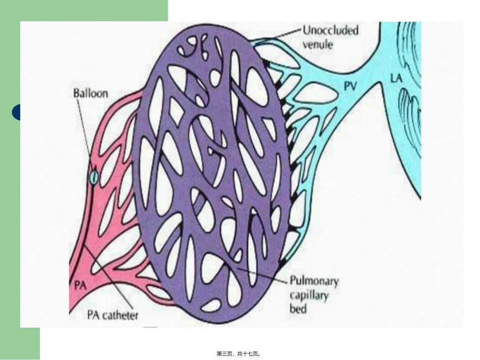CTD-肺动脉高压_第3页