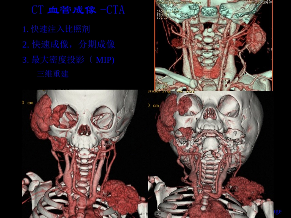 CTMR在儿科的应用-孙国强_第3页