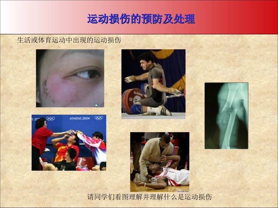初级中学八年级体育《运动损伤与处理二》课件_第3页