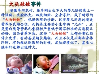《蛋白质和核酸》课件１