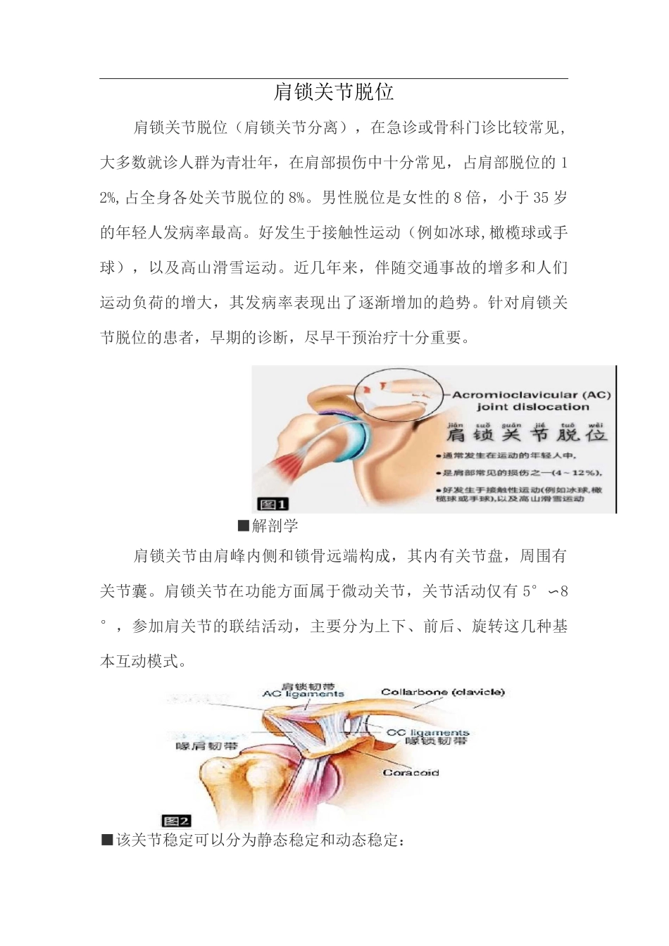 肩锁关节脱位_第1页