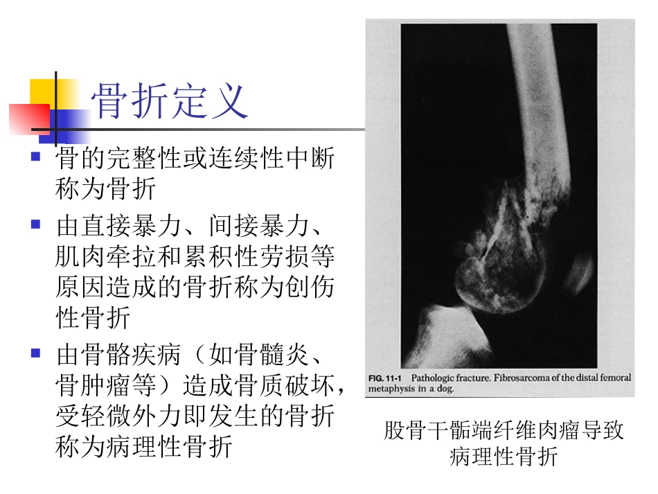 骨折急救固定法_第2页