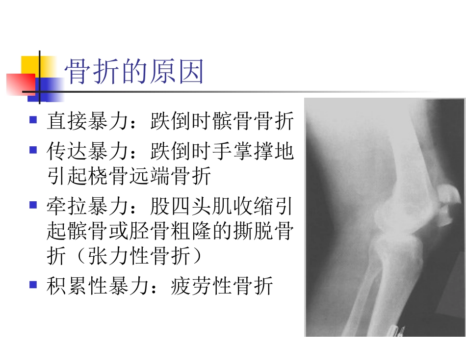 骨折急救固定法_第3页