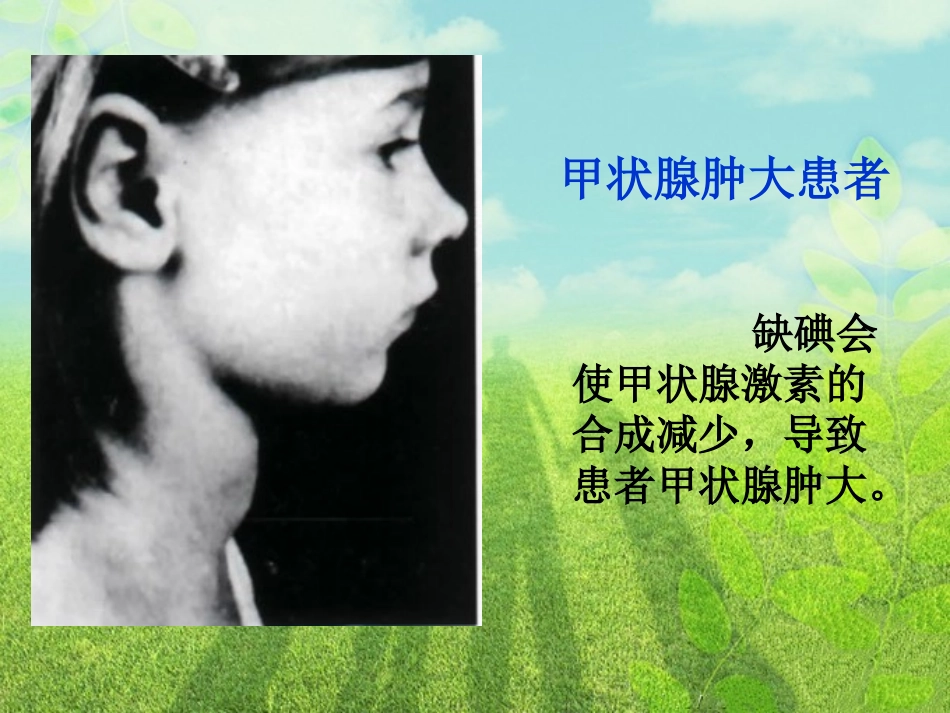 甲状腺和甲状腺激素_第3页