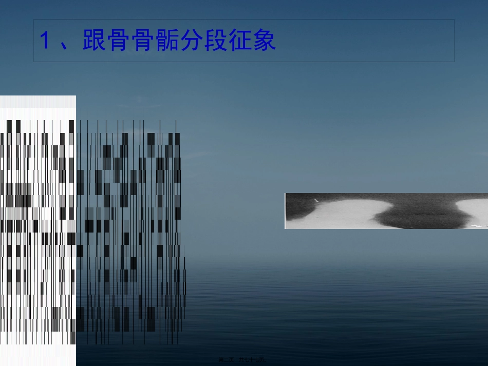 下肢骨影像常见变异_第2页