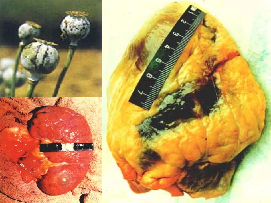 开课虎门销烟_第3页