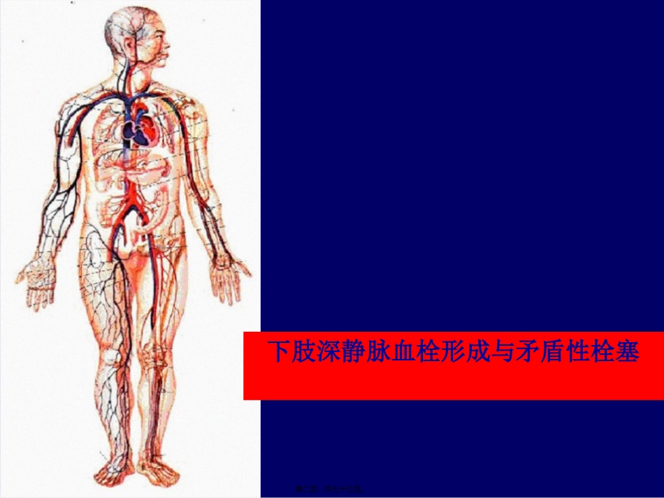 下肢静脉血栓详解_第2页