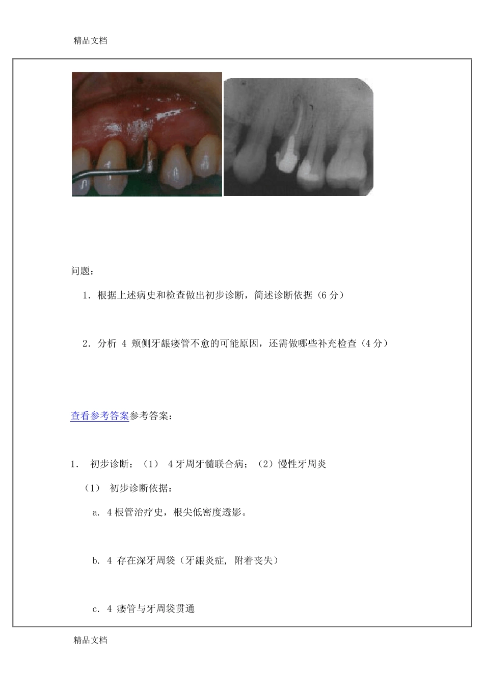 最新口腔医学院牙周病学-病例分析 _第2页
