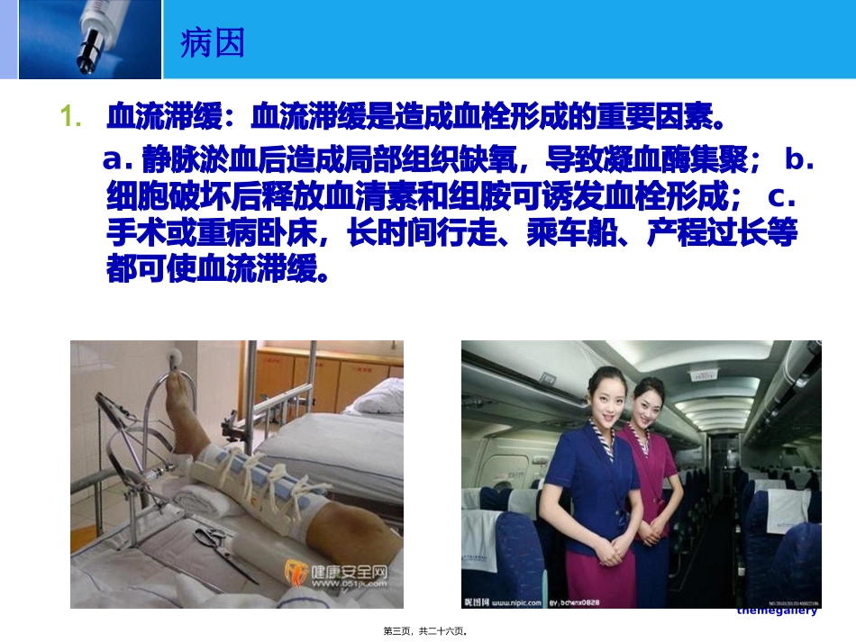 下肢深静脉血栓PPT_第3页