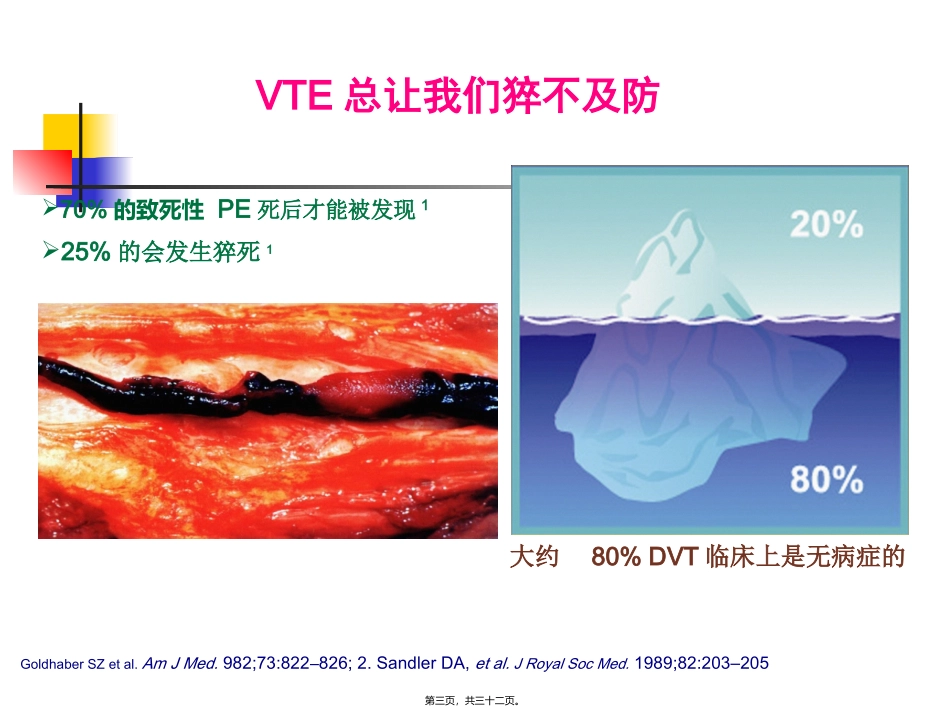 下肢深静脉血栓讲课_第3页
