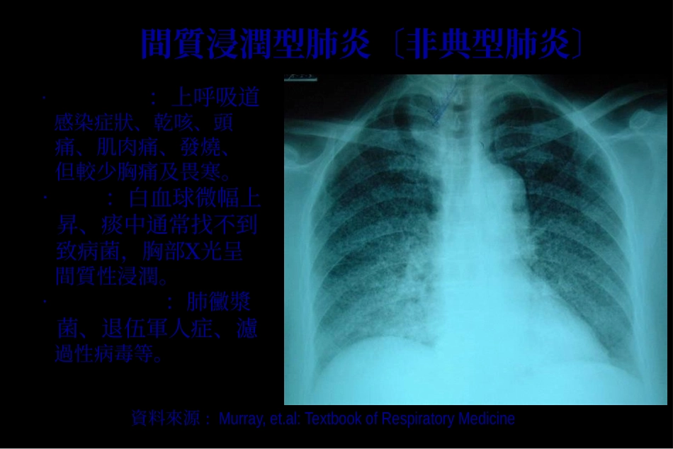 严重急性呼吸道症候群_第3页