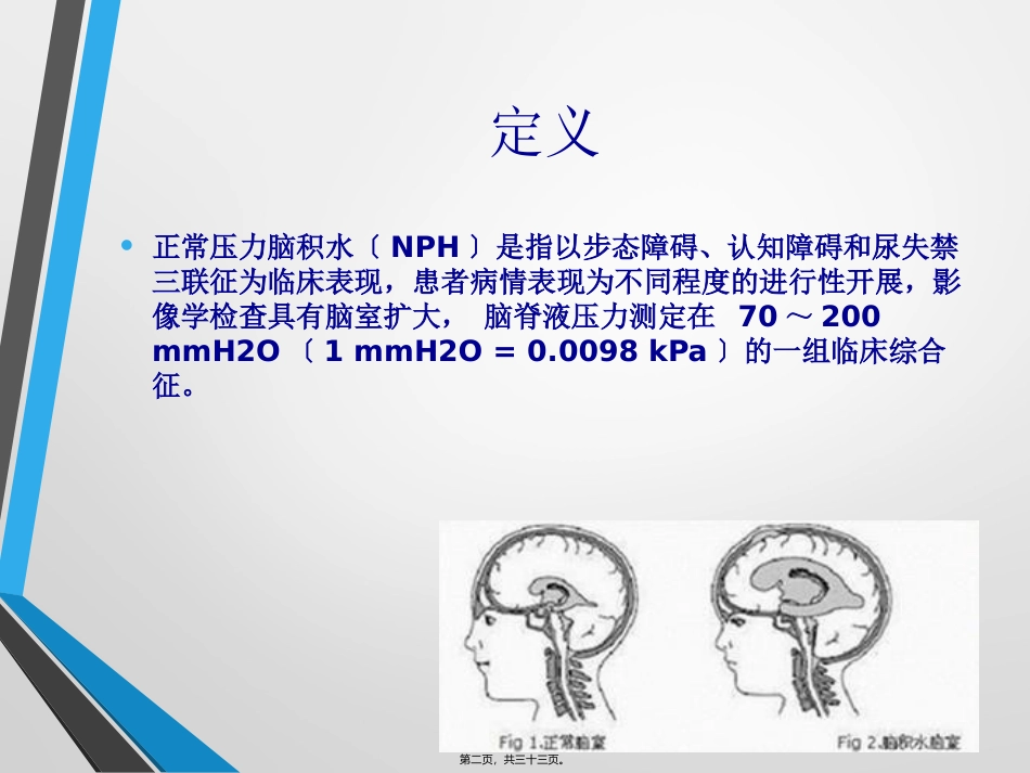 中国特发性正常压力脑积水诊治专家共识(2016)_第2页