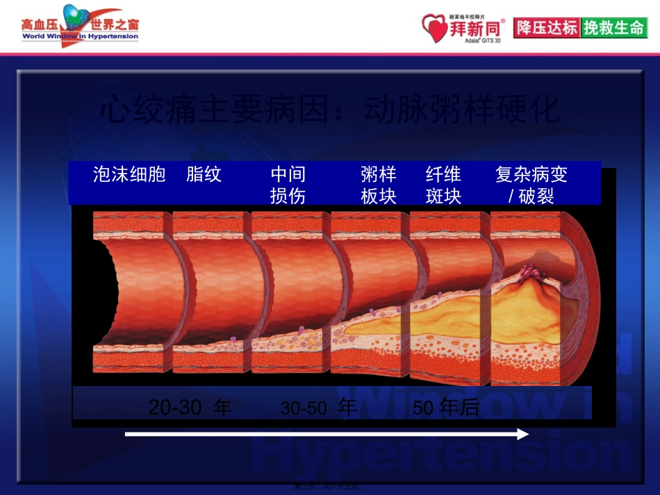 中国稳定性心绞痛指南带来的启示+解说词-final_第3页