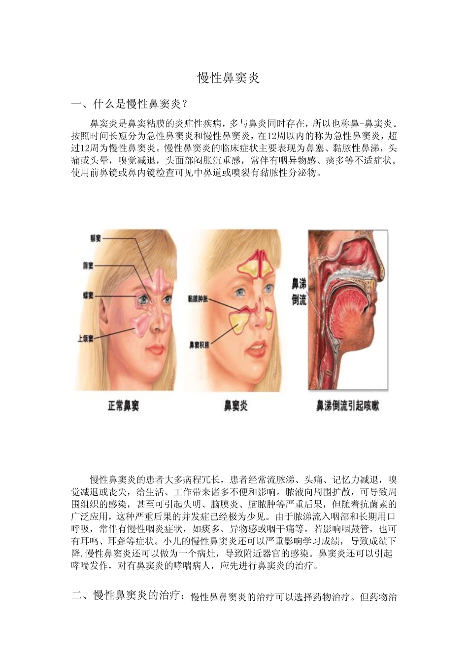 慢性鼻窦炎诊治--科室宣传 _第1页