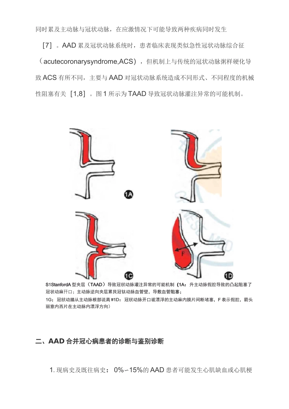2021急性主动脉夹层合并冠心病的诊断与治疗策略中国专家共识(全文)_第2页