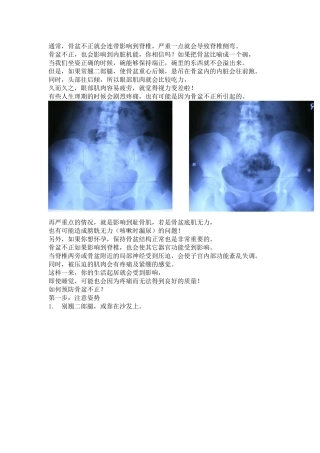 骨盆不正会带给女孩子什么样的困扰呢？