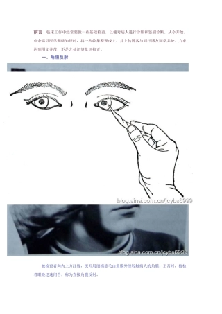 角膜反射和对光反射