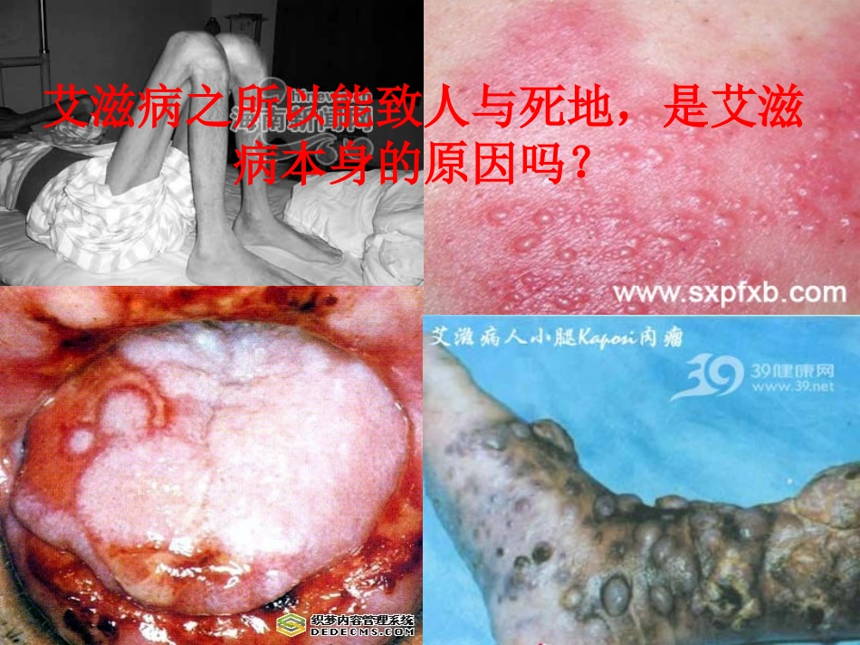 苏教版教学课件免疫对人体稳态的维持_第2页