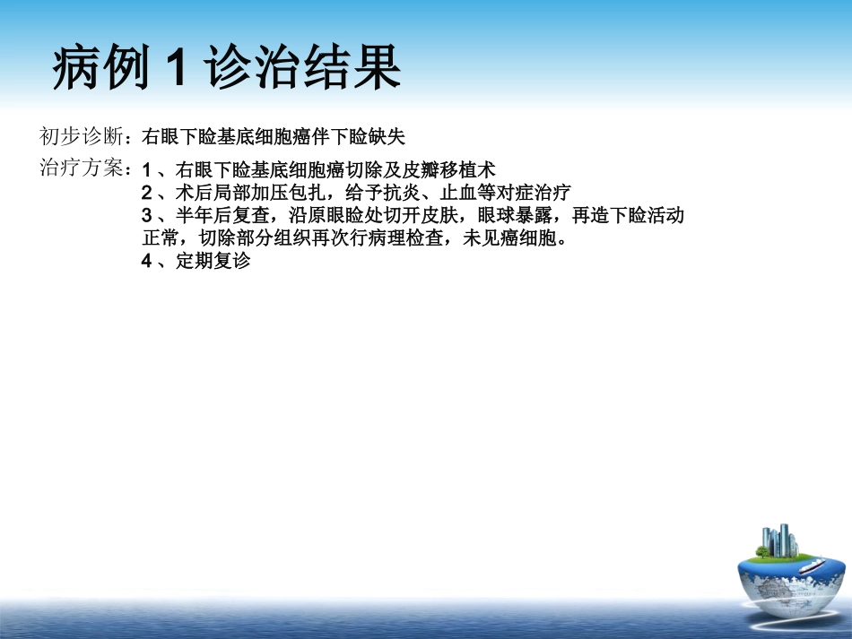 眼睑基底细胞癌_第3页