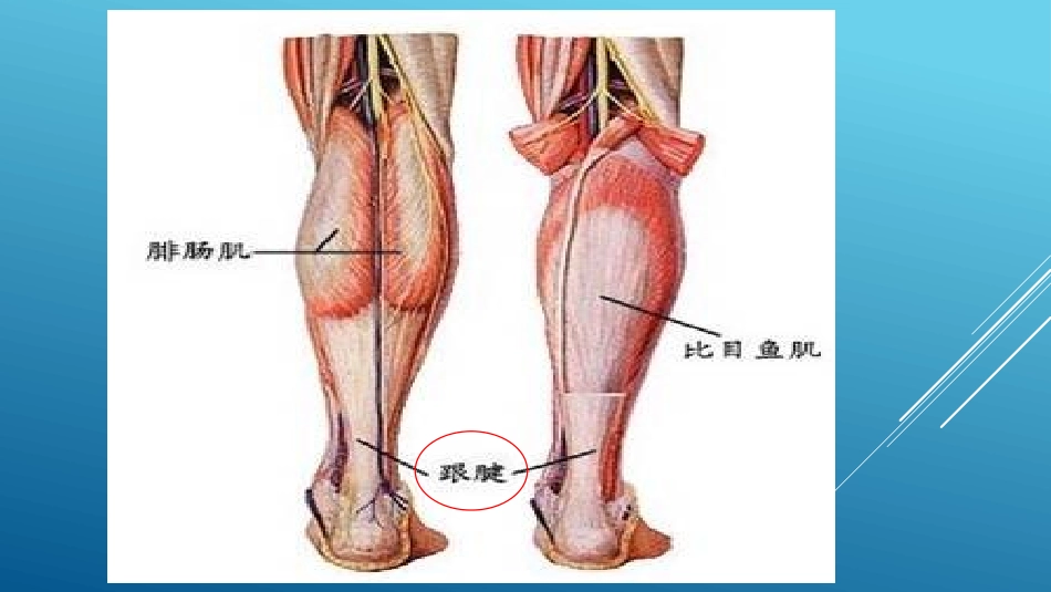 关节镜下跟骨成形术(ECP)_第2页