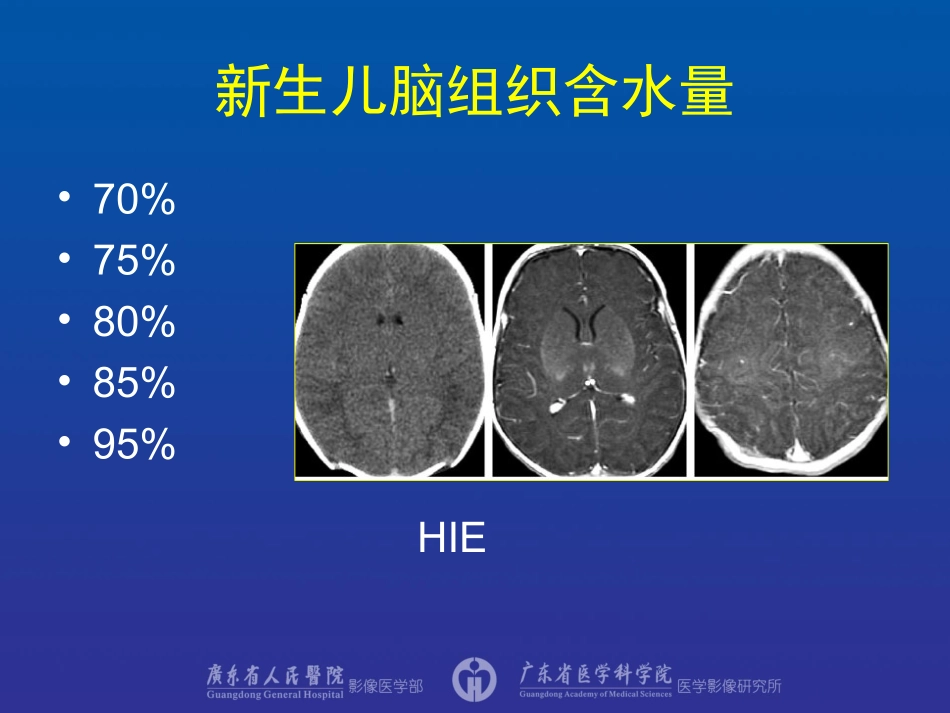 儿童神经影像诊断_第3页