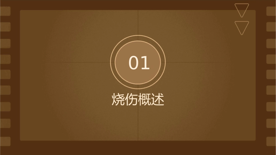 烧伤患者护理课件_第3页