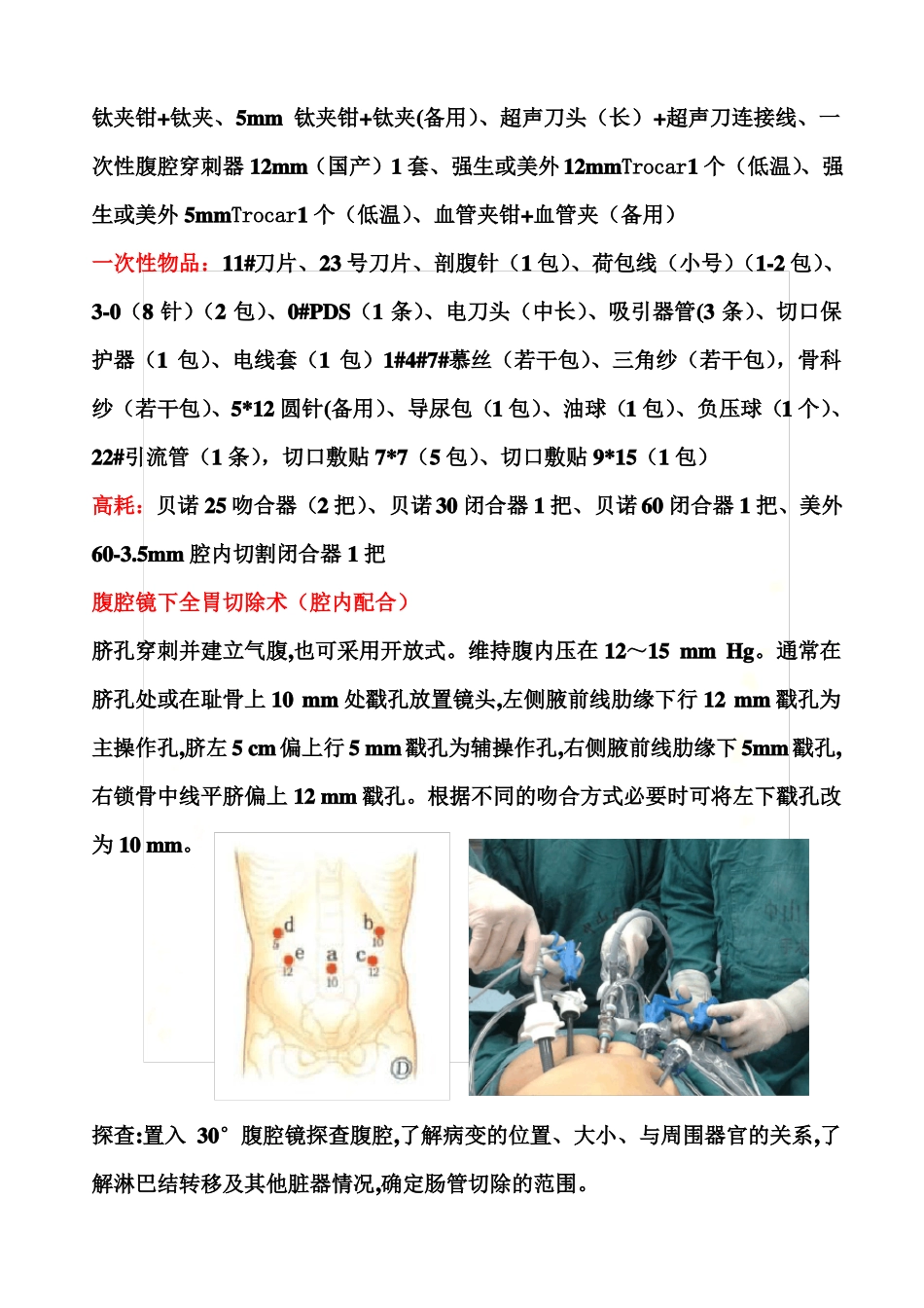 腔镜下全胃切除术手术步骤_第3页