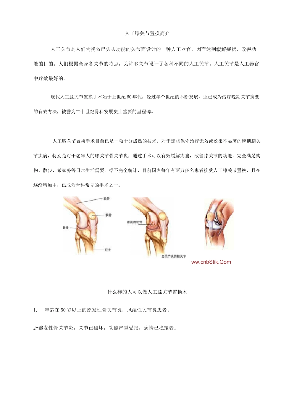 人工膝关节置换手术步骤模板_第1页