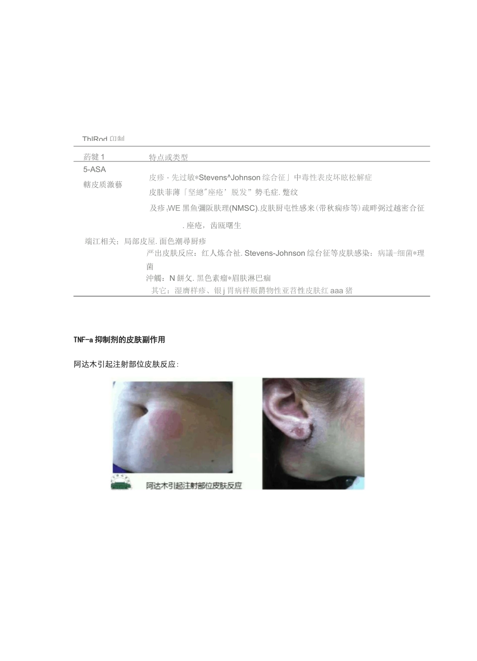 炎症性肠病(IBD)的治疗：重视IBD治疗的副作用_第3页