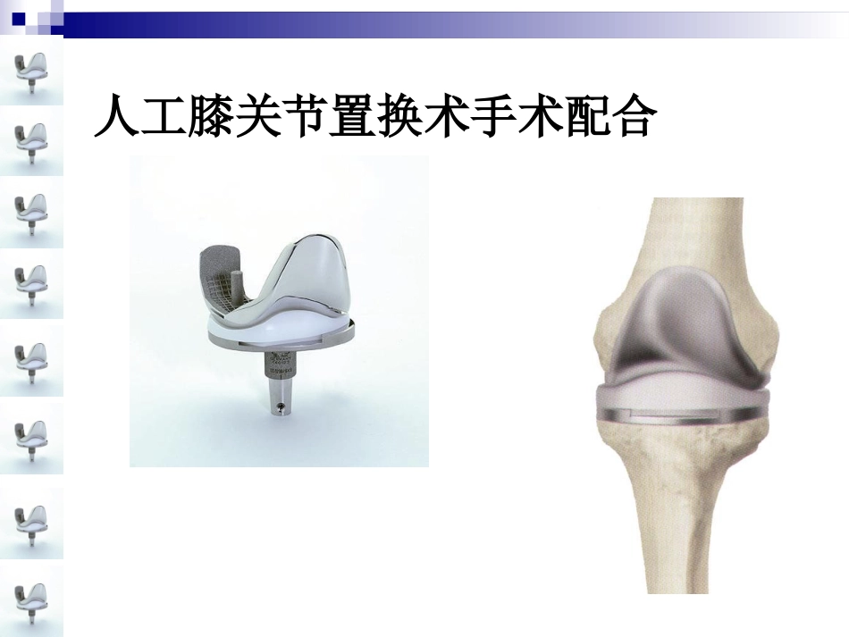 人工膝关节置换术手术配合ppt_第1页