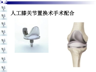 人工膝关节置换术手术配合ppt