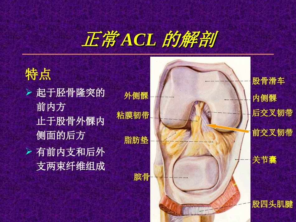 关节镜下膝前交叉韧带损伤的诊治_第3页