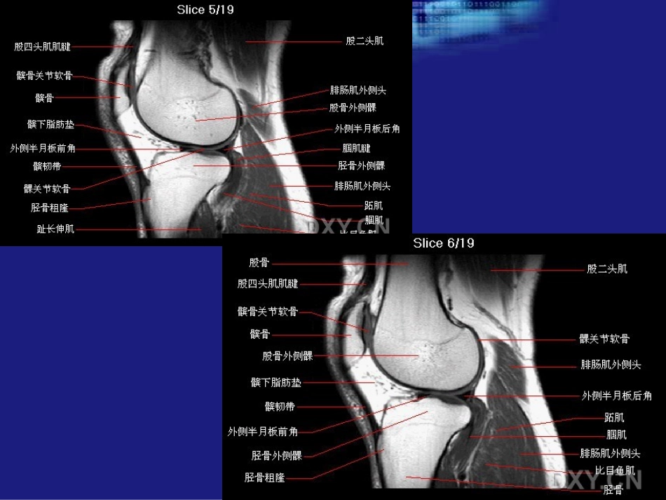 膝关节MRI1_第2页