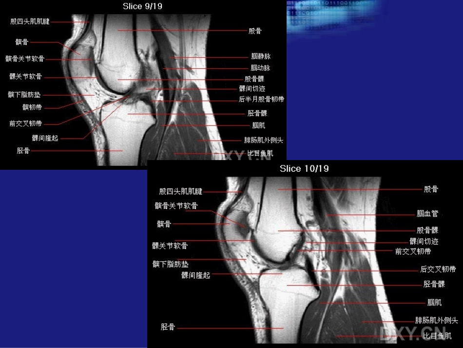膝关节MRI1_第3页