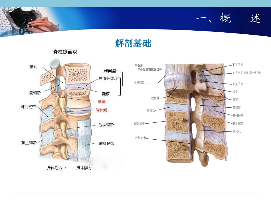 腰椎间盘突出康复_第3页
