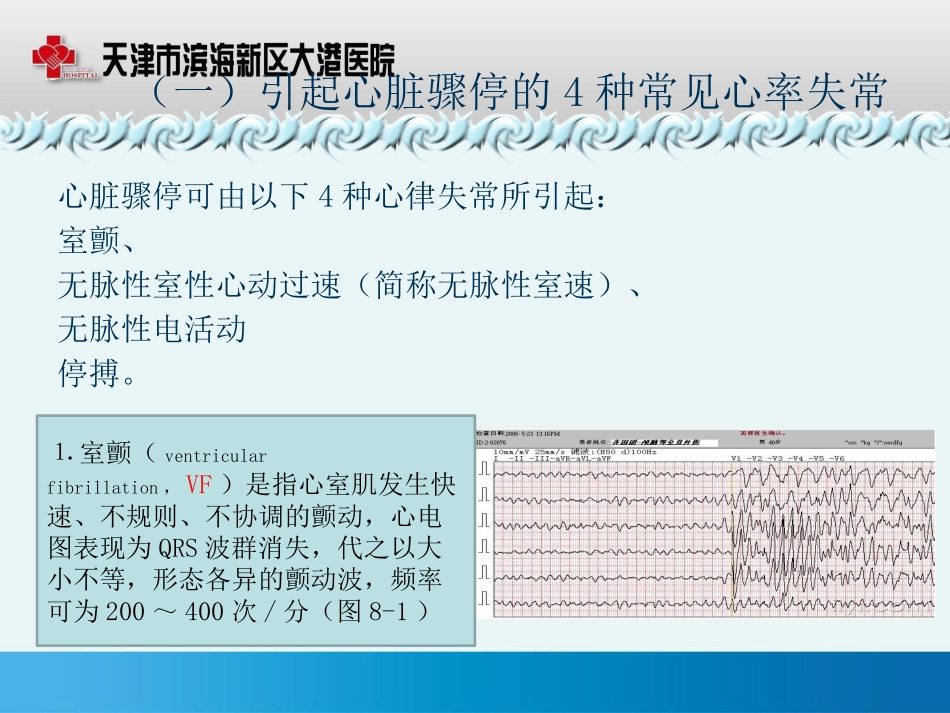 四、心脏骤停与心肺复苏_第3页