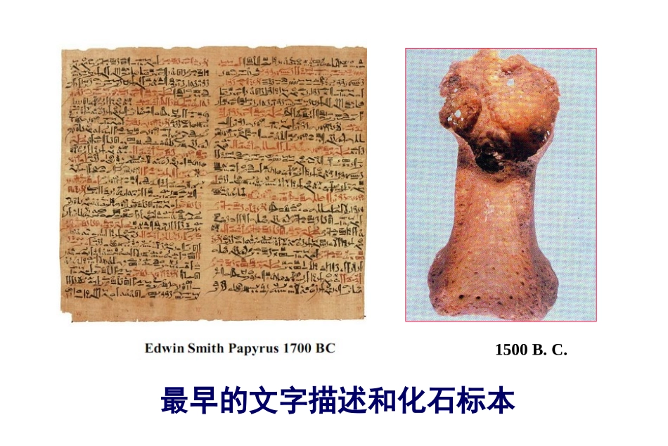 痛风：过去和现在_第3页