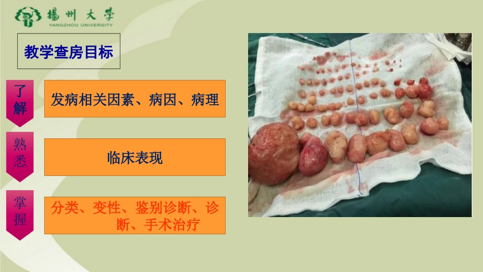 子宫肌瘤教学查房_第3页