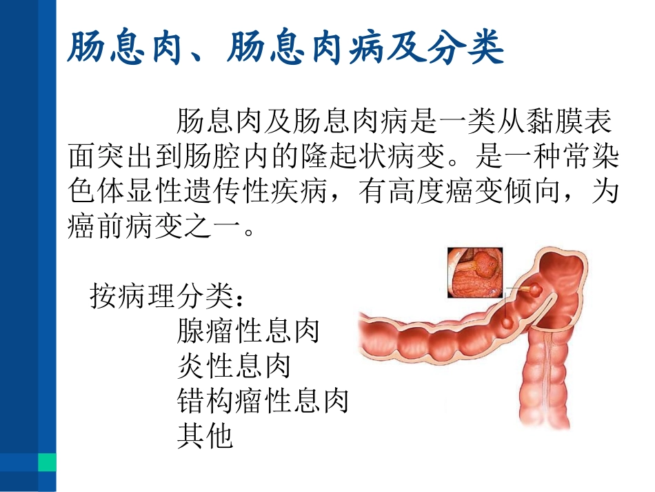 家族性结肠息肉病_第2页
