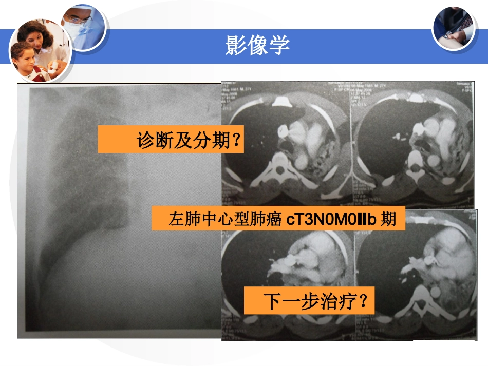 肺癌病例讨论_第3页