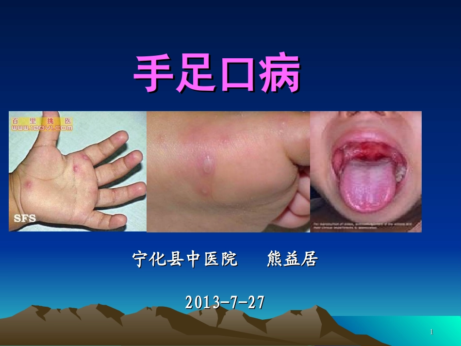 手足口病--jainggao(2013-7-29)_第1页