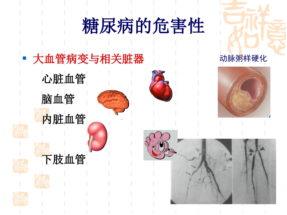 糖尿病综合-围手术_第2页